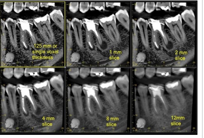 CBCT picture 3.jpg