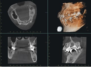 endodontics-xyz.jpg